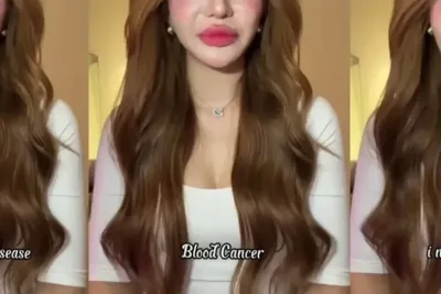 Influencer Vietnam An Thy Umumkan Diagnosis Leukemia, Sempat Abaikan Sinyal Tubuh