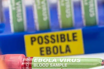 Tom Frieden: Dunia Gagal dalam Ujian Stres Ebola, Belum Siap Hadapi Pandemi