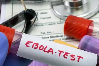Kasus Ebola di Kongo Meningkat Jadi 260, Pemerintah Konfirmasi