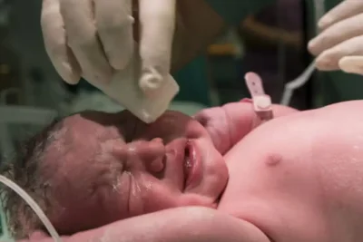 Rawat Tali Pusat Bayi Baru Lahir dengan Lima Langkah Sederhana Ini