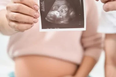 4 Posisi Plasenta dan Dampaknya bagi Ibu Hamil