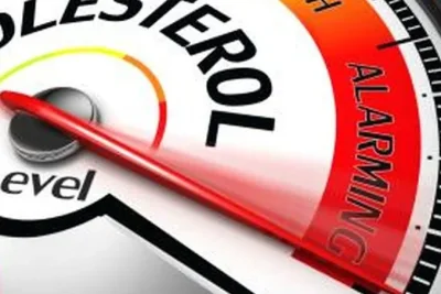 Kaki Menebal Bisa Jadi Tanda Kolesterol Tinggi yang Jarang Disadari