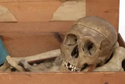 Glasgow Auction House Withdraws Human Bones from Sale After Ethics Backlash